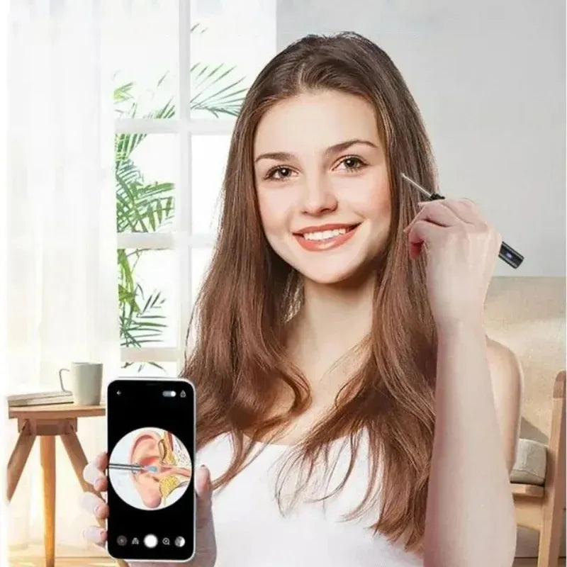 LIMPIADOR DE OÍDOS CON CÁMARA WIFI OTOSCOPIO DIGITAL